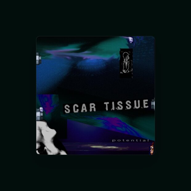 Scar Tissue